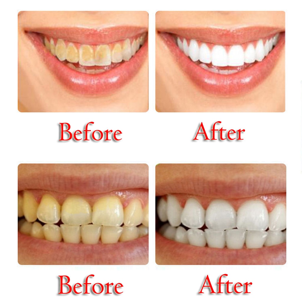 Organic Toothpaste Teeth Whitening Organic Toothpaste Teeth Whitening