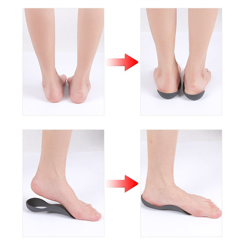 Orthopedic Insoles Orthotics Flat Foot Health Sole Pad for Shoes Insert Arch Support Pad for Plantar Fasciitis Feet Care