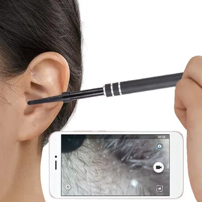 Otoscope Earpick Video Tool Otoscope Earpick Video Tool
