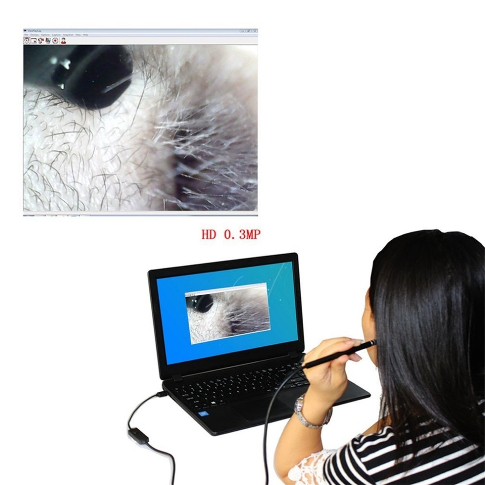 Otoscope Earpick Video Tool Otoscope Earpick Video Tool