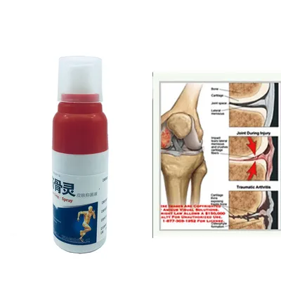 Pain Relief Spray Body Pain Reliever Pain Relief Spray Body Pain Reliever