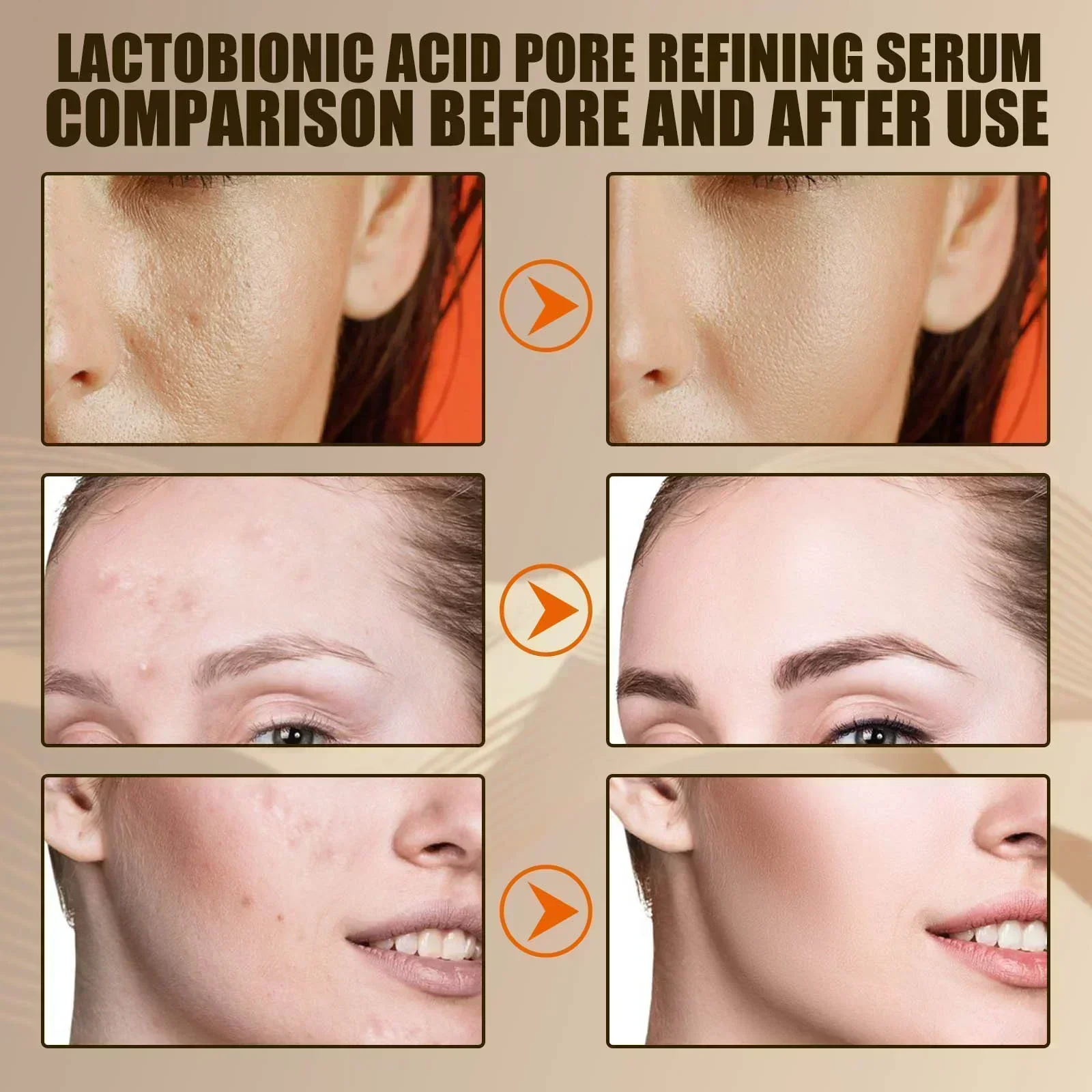 Pore Shrink Face Serum Remove Blackheads Acne Acidity Oil Control Repair Essence Moisturizing Nourish Pores Firming