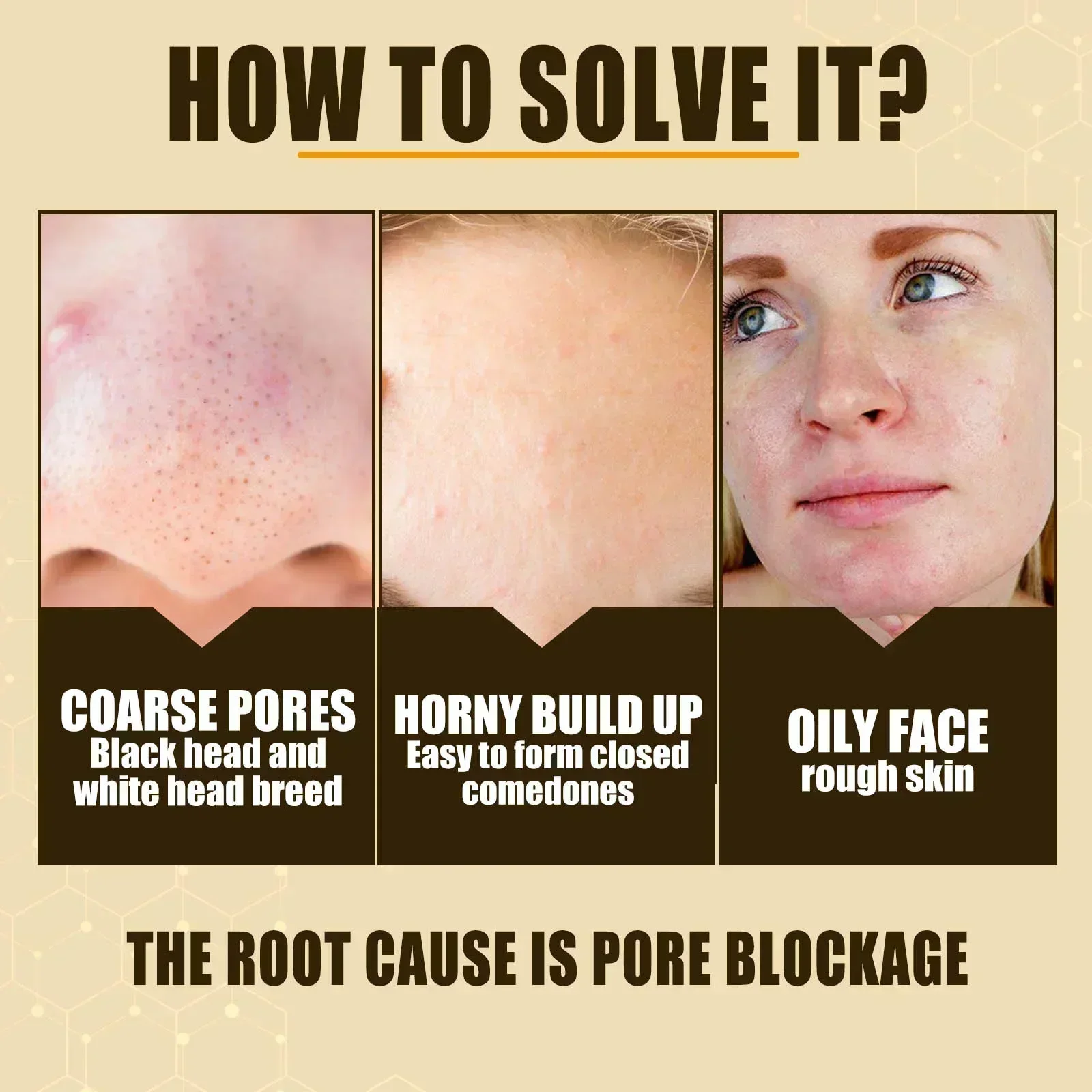 Pore Shrink Face Serum Remove Blackheads Acne Acidity Oil Control Repair Essence Moisturizing Nourish Pores Firming
