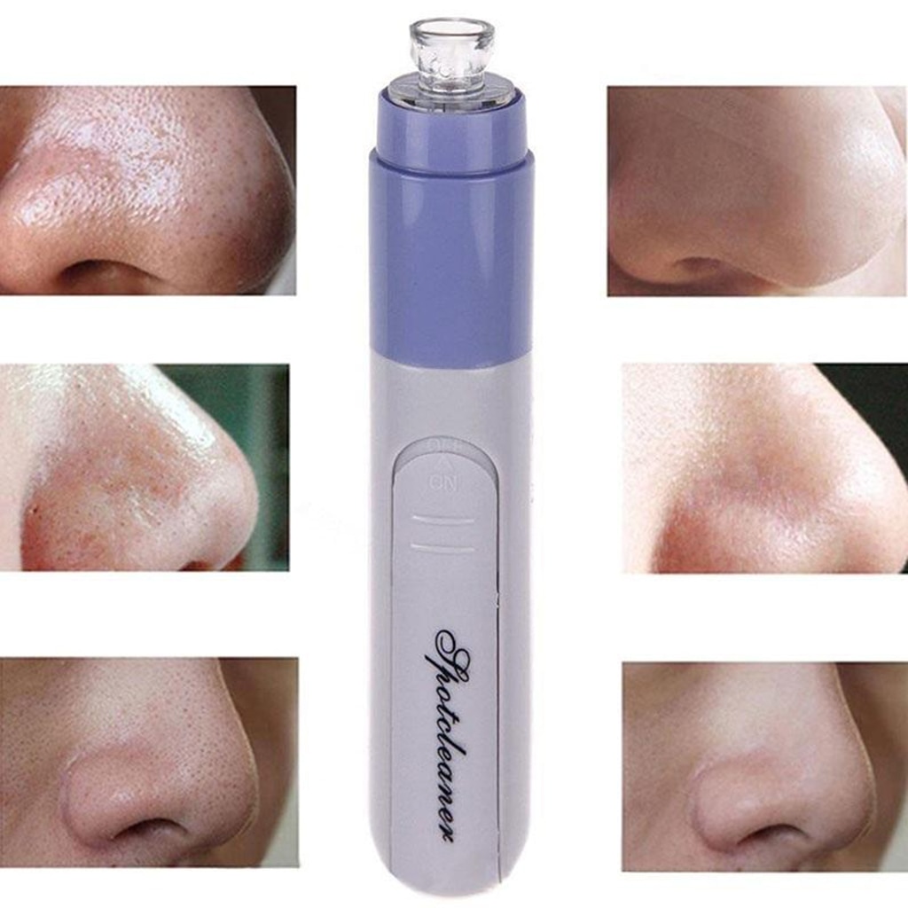 Pore Sucker Suction Blackhead Remover