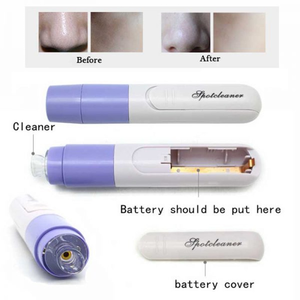 Pore Sucker Suction Blackhead Remover