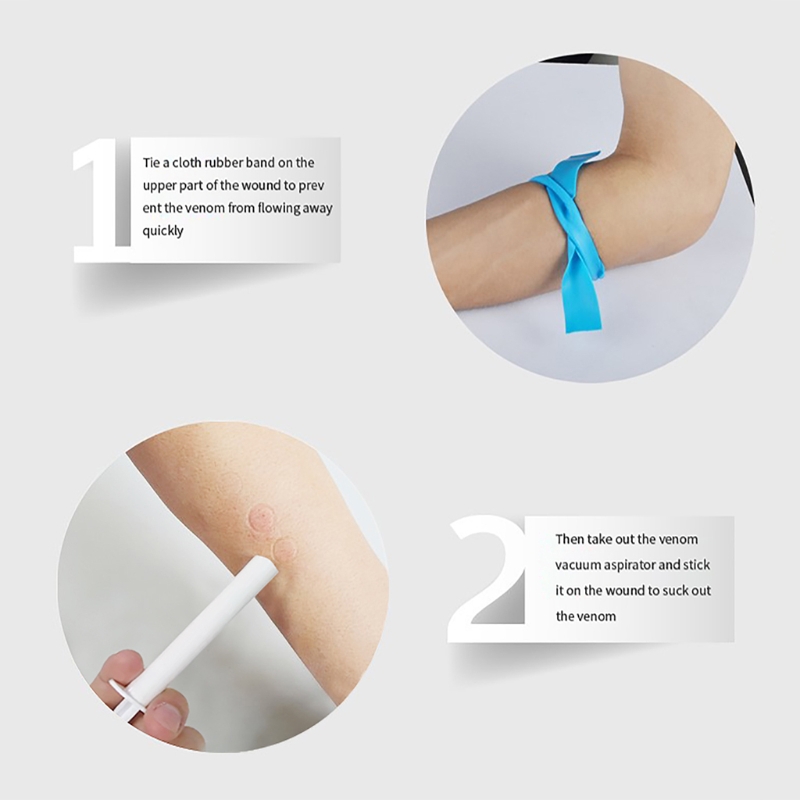 Portable Bug Bite Suction Tool