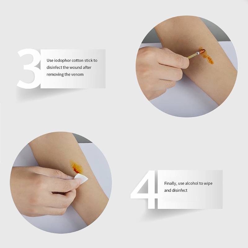 Portable Bug Bite Suction Tool