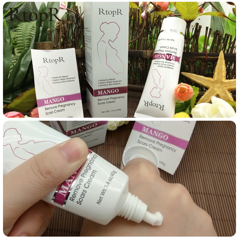Pregnancy Stretch Mark Cream Pregnancy Stretch Mark Cream