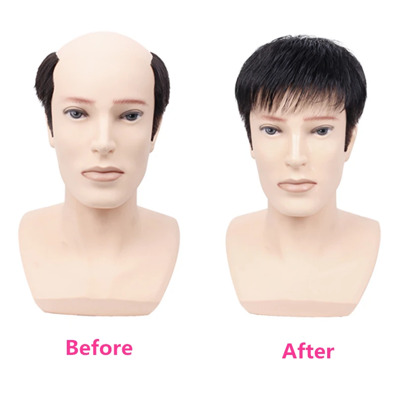 Prosthetic Hair Male 100% Human Hair Toupee Wigs for Man Replacement System Men's WIg Real Hair for Baldness Cover