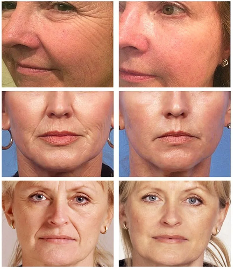 Pure Retinol Wrinkle Remover Face Serum Fade Fine Lines Anti-aging Essence Deep Moisturizing Whitening Firming Repair Pure Retinol Wrinkle Remover Face Serum Fade Fine Lines Anti-aging Essence Deep Moisturizing Whitening Firming Repair