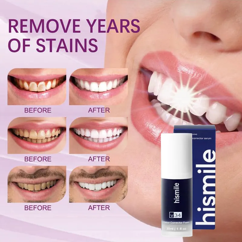 Purple Whitening Toothpaste Cleans Mouth Fresh Breath Remove Yellow Stains Protect Teeth White Decontamination Care 2023 Purple Whitening Toothpaste Cleans Mouth Fresh Breath Remove Yellow Stains Protect Teeth White Decontamination Care 2023