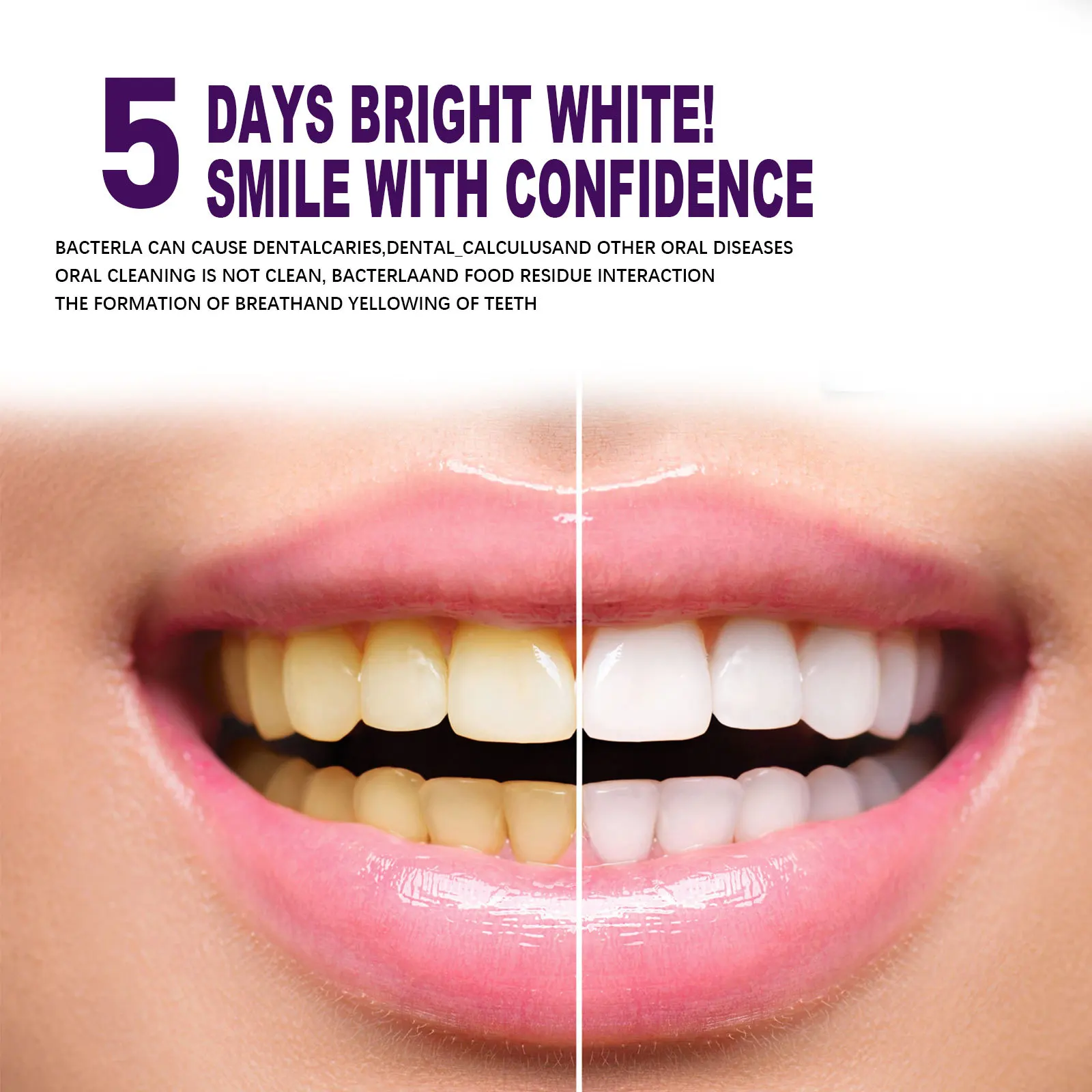 Purple Whitening Toothpaste Cleans Mouth Fresh Breath Remove Yellow Stains Protect Teeth White Decontamination Care 2023 Purple Whitening Toothpaste Cleans Mouth Fresh Breath Remove Yellow Stains Protect Teeth White Decontamination Care 2023