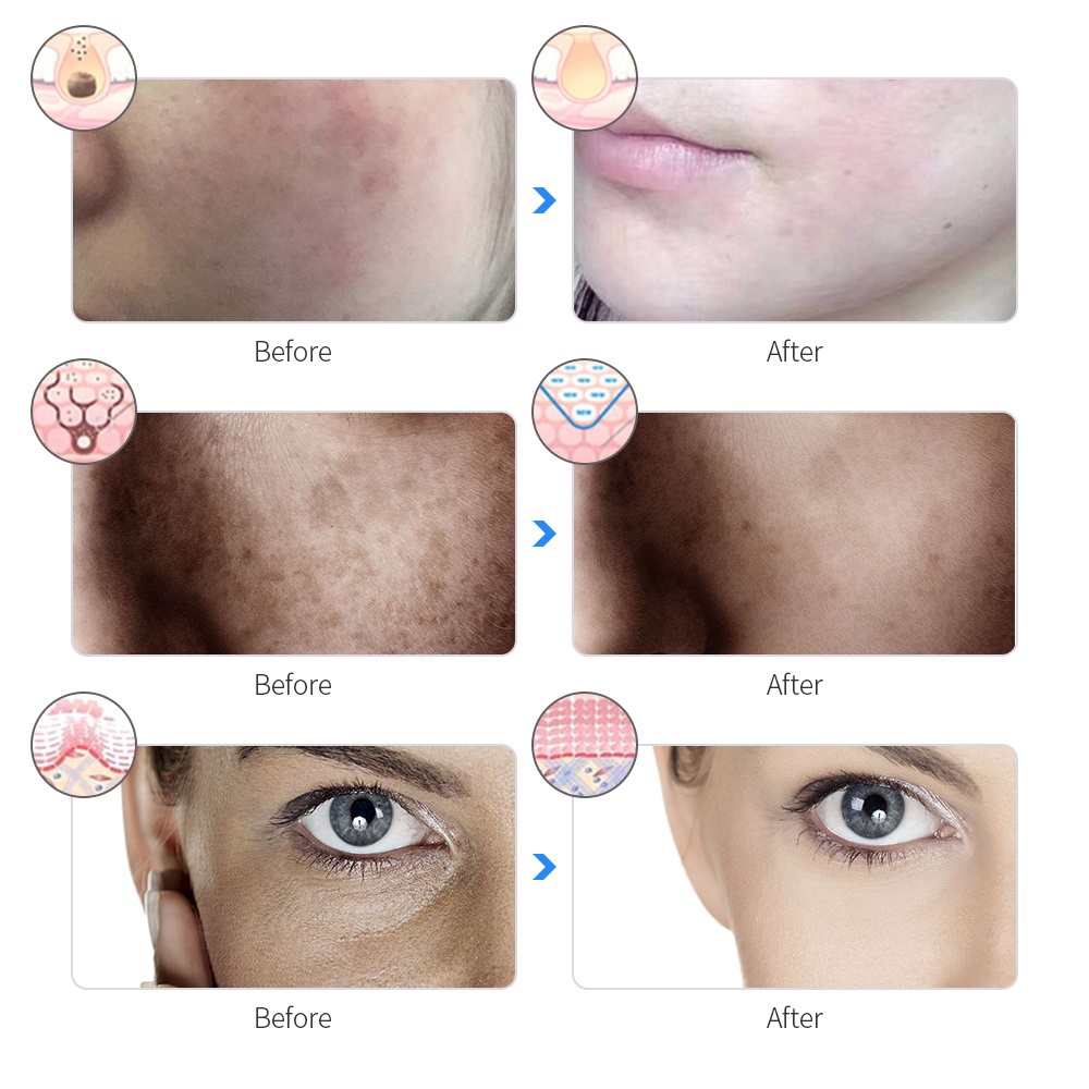 Rechargeable Facial LED Mask 7 Colors LED Photon Therapy Beauty Mask Skin Rejuvenation Home Face Lifting Whitening
