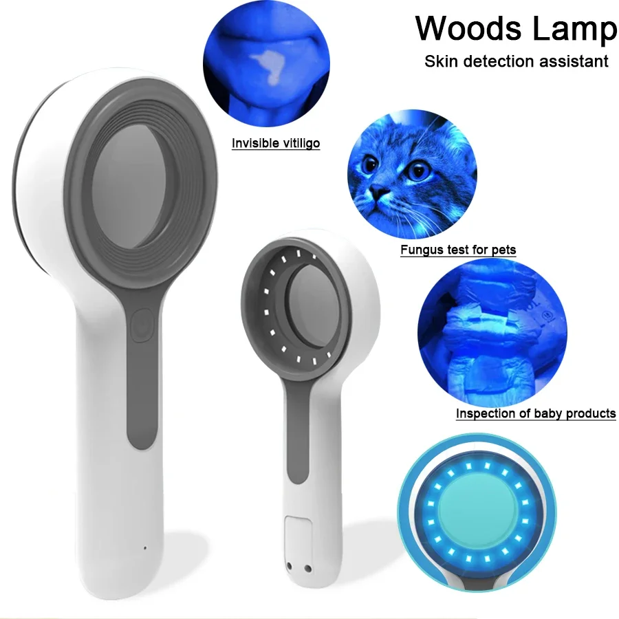 Rechargeable Wood's Lamp Ultraviolet Skin Analysis For Skin Examination Test Medical Diagnostic Analyzer Machine