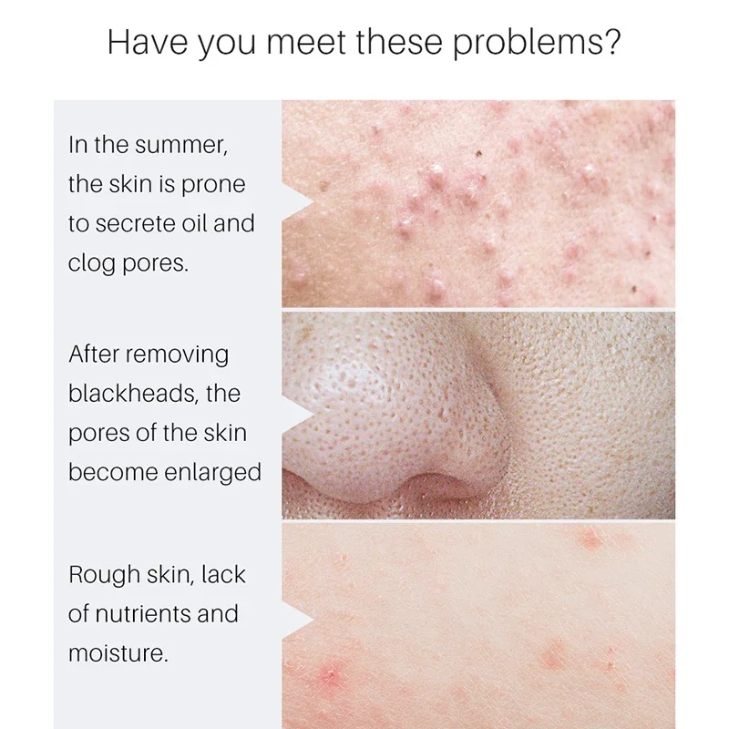 Removing Large Pores Pore Shrinking Serum Face Tightening Repairing Facial Pore Minimizing Moisturizing Skin Care