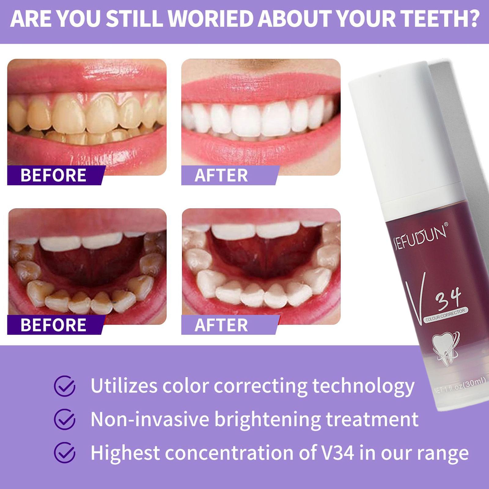 Repair Bright White Anti Sensitive Toothpaste Gel Gentle Whitening Toothpaste Remove Smoke Stains Plaque Fresh Breath