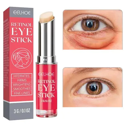 Retinol Anti-Wrinkle Eye Cream Remove Eye Bags Dark Circles Anti Aging Lifting Firming Whitening Moisturizing Brighten Retinol Anti-Wrinkle Eye Cream Remove Eye Bags Dark Circles Anti Aging Lifting Firming Whitening Moisturizing Brighten