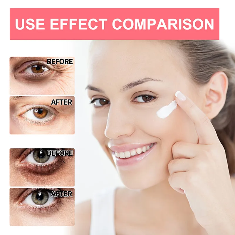 Retinol Anti-Wrinkle Eye Cream Remove Eye Bags Dark Circles Anti Aging Lifting Firming Whitening Moisturizing Brighten Retinol Anti-Wrinkle Eye Cream Remove Eye Bags Dark Circles Anti Aging Lifting Firming Whitening Moisturizing Brighten