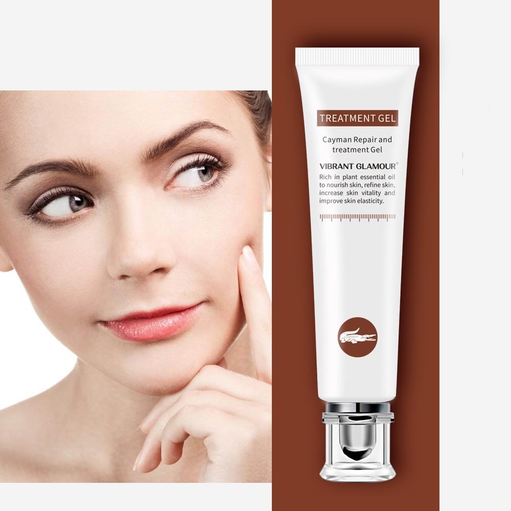 Scar Cream Acne Treatment Gel Ointment Scar Cream Acne Treatment Gel Ointment