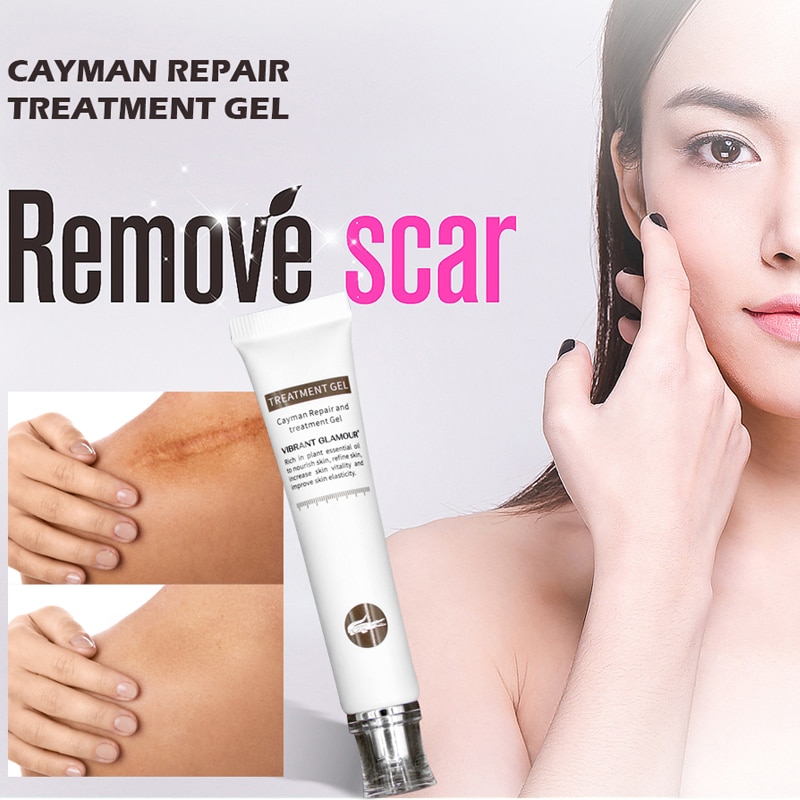Scar Cream Acne Treatment Gel Ointment Scar Cream Acne Treatment Gel Ointment