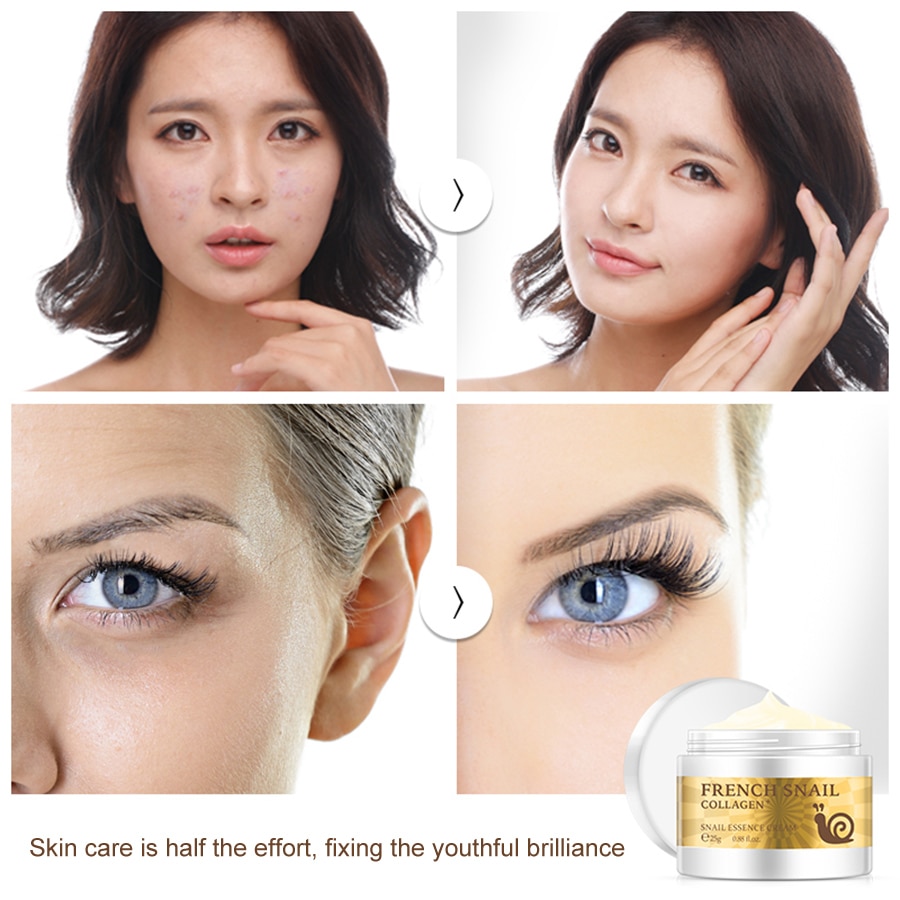 Scar Removal Collagen Face Cream Scar Removal Collagen Face Cream