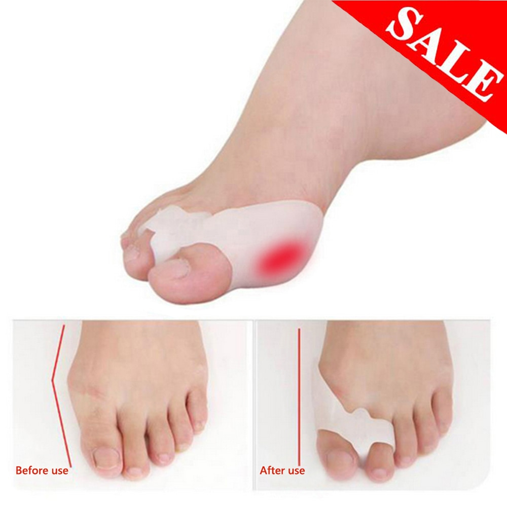 Silicone Bunion Pads Hallux Correctors (2 pcs) Silicone Bunion Pads Hallux Correctors (2 pcs)