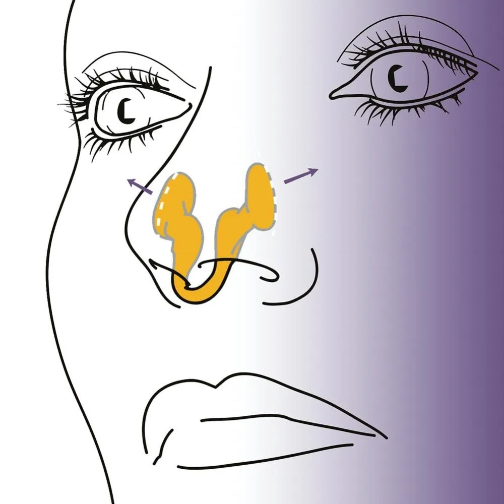 Silicone Nose Clip Anti Snoring Nasal Dilator Stop Snore Aid Easy Breathe Improve Sleeping Rhinitis