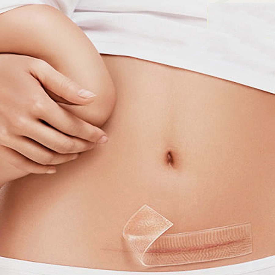 Silicone Scar Sheets Reusable Patches Silicone Scar Sheets Reusable Patches