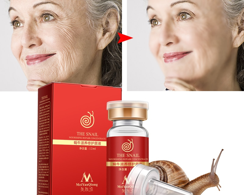 Skin Serum Anti-Acne Snail Concentrate Skin Serum Anti-Acne Snail Concentrate