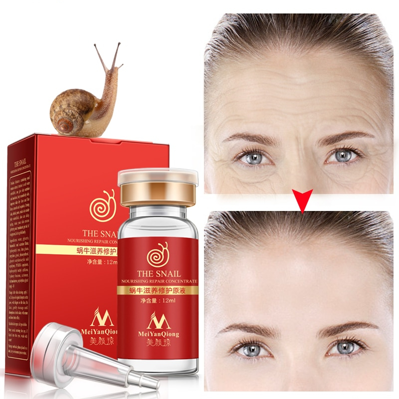 Skin Serum Anti-Acne Snail Concentrate Skin Serum Anti-Acne Snail Concentrate