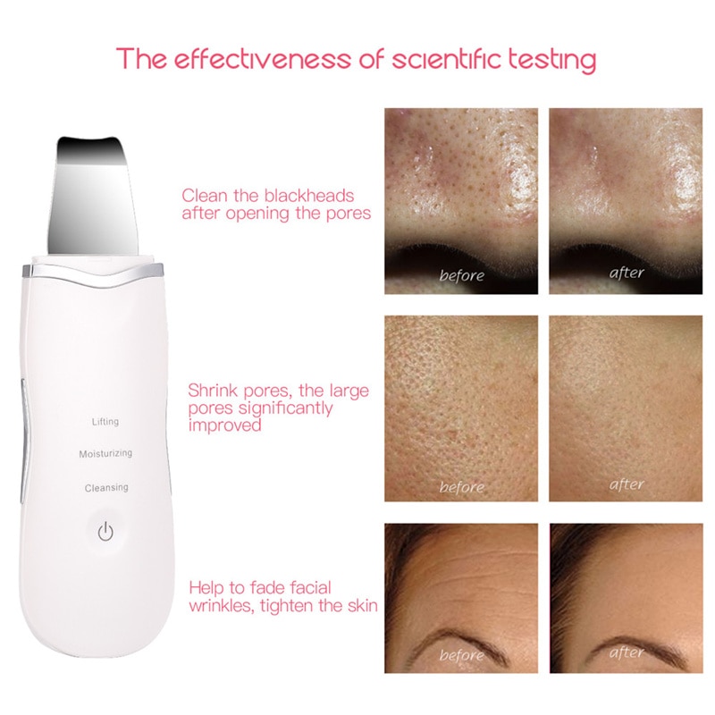 Skin Spatula Ultrasonic Exfoliator Skin Spatula Ultrasonic Exfoliator