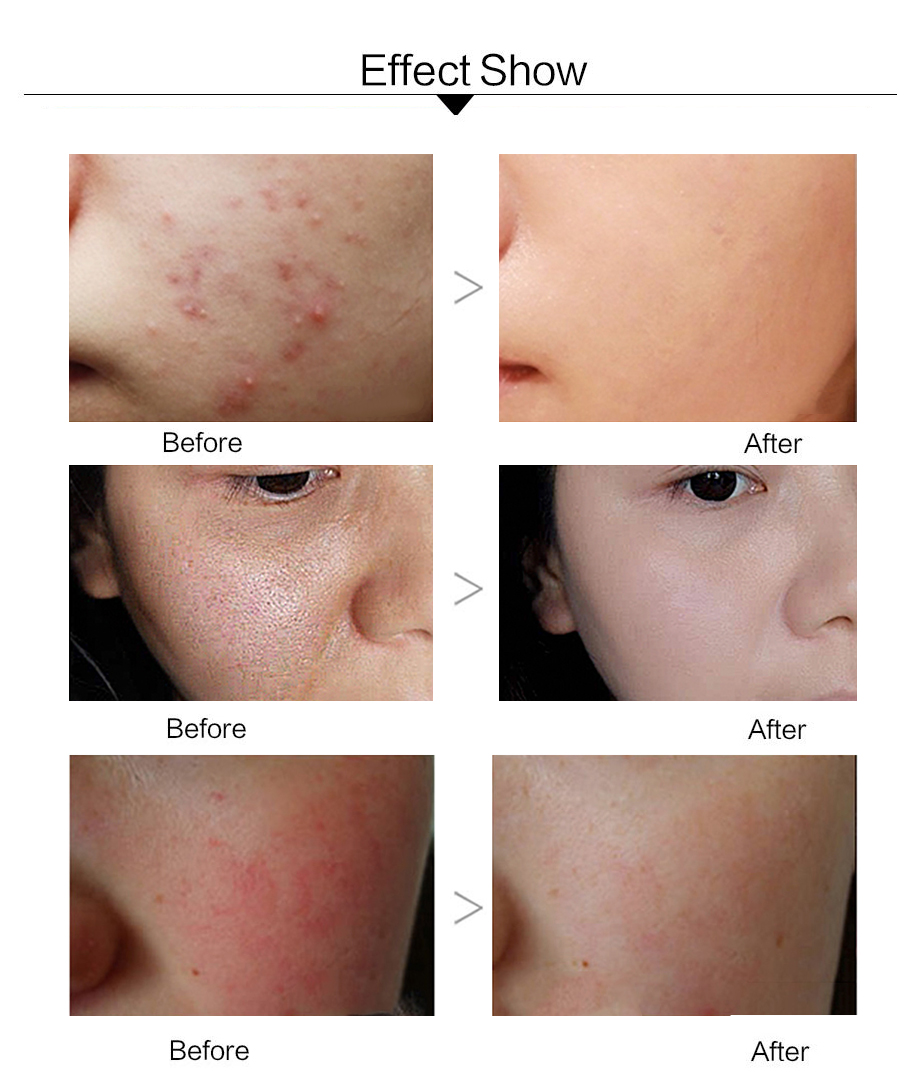 Snail Cream Anti-aging Facial Care