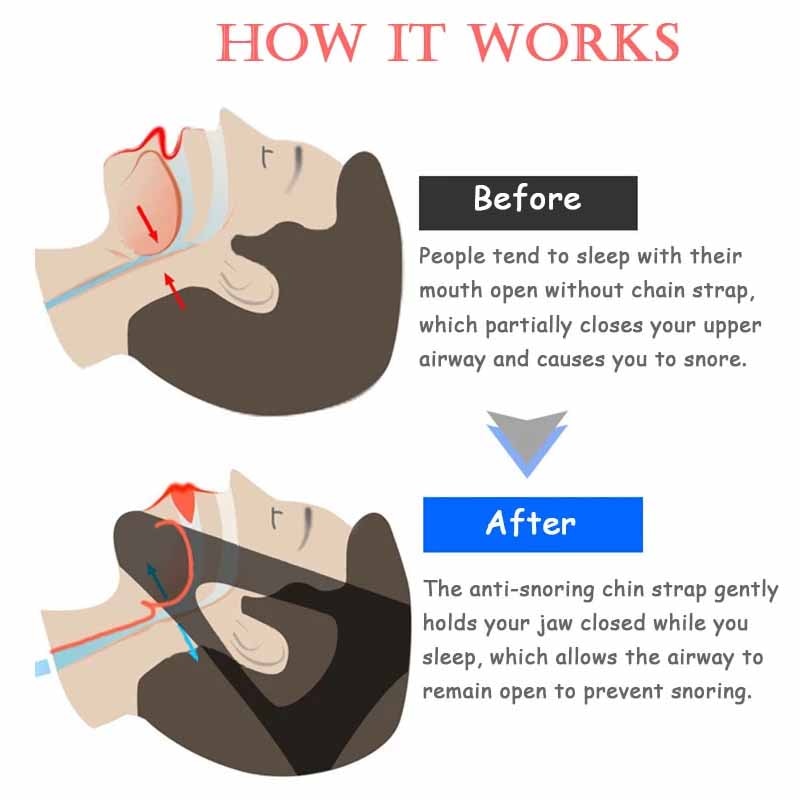 Snoring Chin Strap Jaw Sleeping Aid