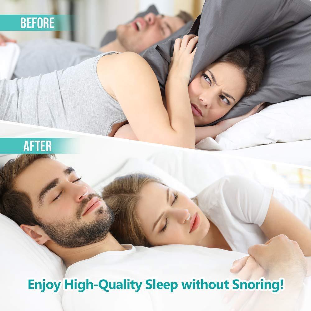 Snoring Nose Clip Magnetic Sleeping Aid (4 pcs) Snoring Nose Clip Magnetic Sleeping Aid (4 pcs)