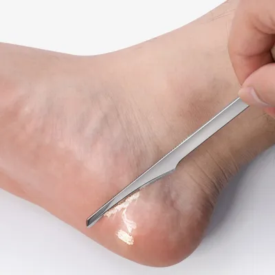 Stainless Steel Foot Skin Scraper