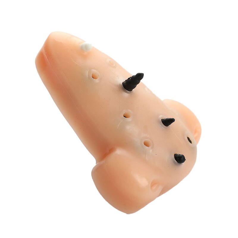 Stress Relief Blackhead Toy Stress Relief Blackhead Toy