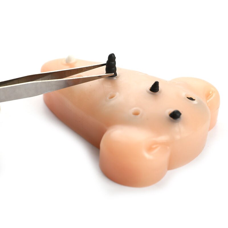 Stress Relief Blackhead Toy Stress Relief Blackhead Toy