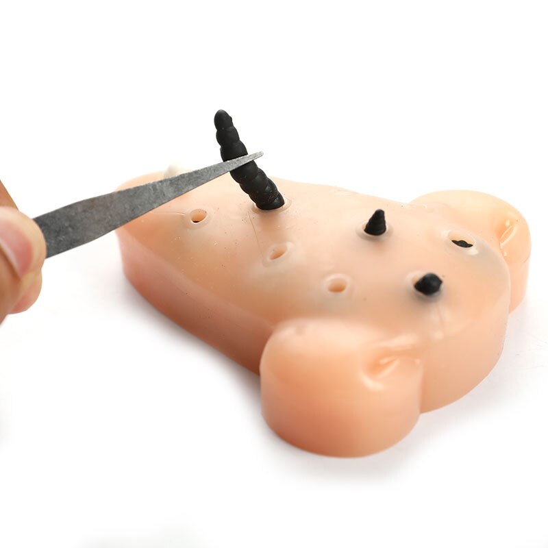 Stress Relief Blackhead Toy Stress Relief Blackhead Toy
