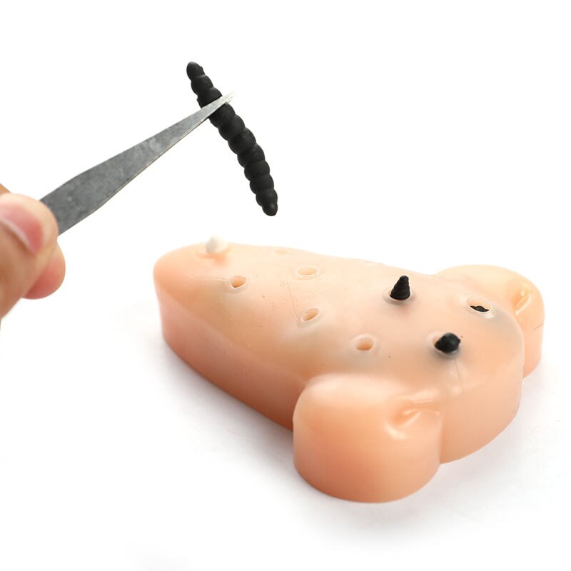 Stress Relief Blackhead Toy Stress Relief Blackhead Toy