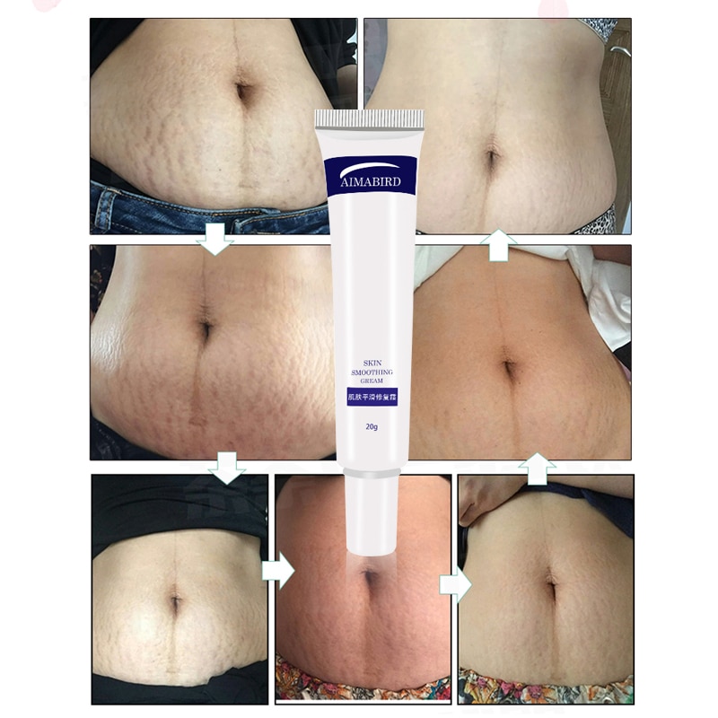 Stretch Mark Cream Skin Repair Stretch Mark Cream Skin Repair