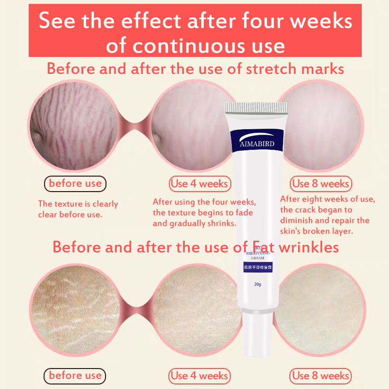 Stretch Mark Cream Skin Repair Stretch Mark Cream Skin Repair