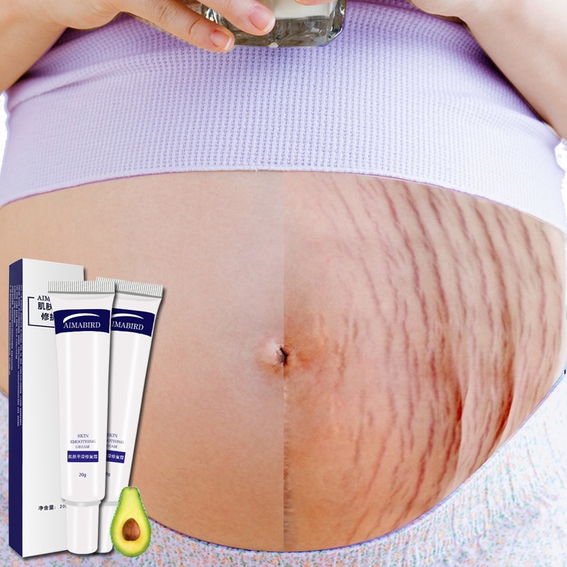 Stretch Mark Cream Skin Repair Stretch Mark Cream Skin Repair