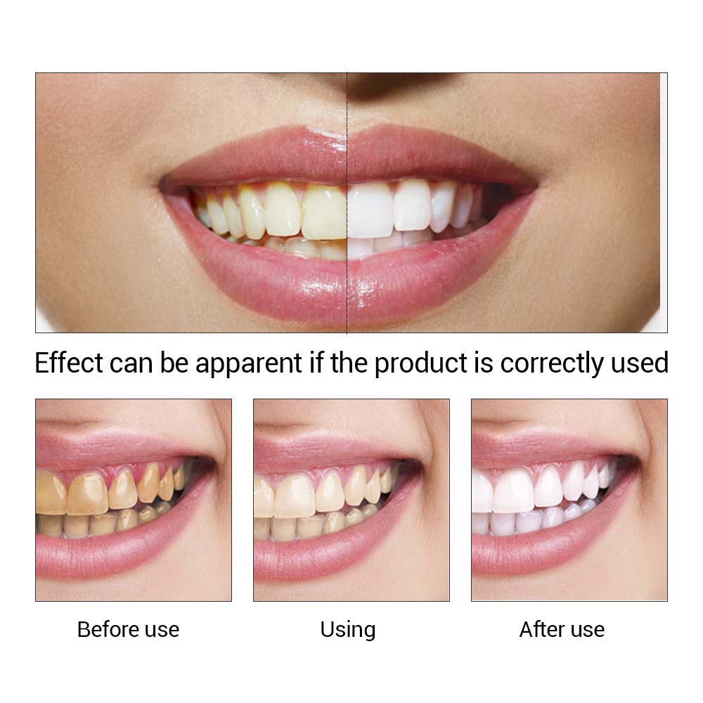 Teeth Bleaching Cleaning Serum
