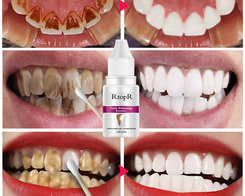 Teeth Whitening Kit Dental Cleanser