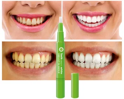 Teeth Whitening Pen Stain Remover