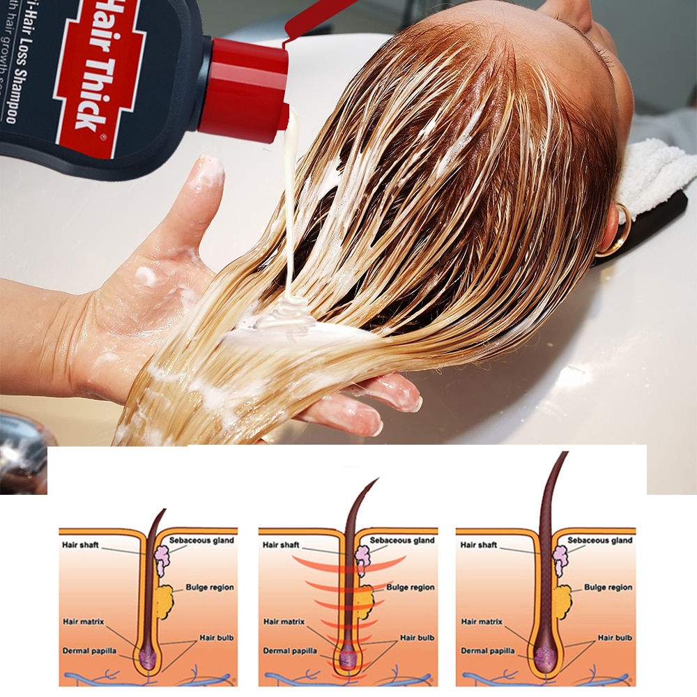 Thickening Shampoo Hair Growth Essence Thickening Shampoo Hair Growth Essence