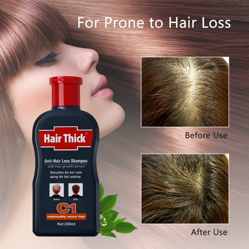 Thickening Shampoo Hair Growth Essence Thickening Shampoo Hair Growth Essence