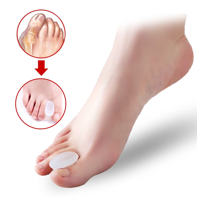 Toe Corrector Orthopedic Bone Straightener