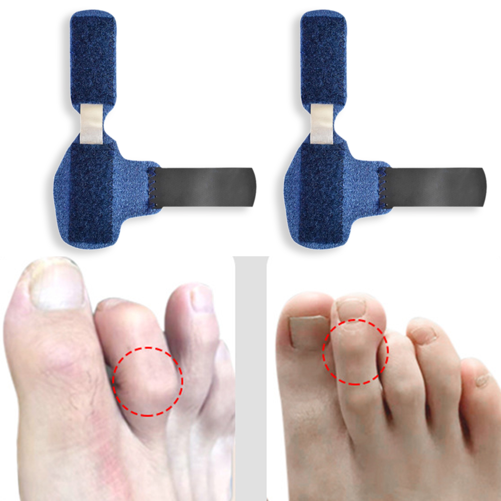 Toe Splint Straightener For Hammer Toe Corrector Crooked Toe Claw Toe Stabilizer Support Feet Corrector Pain Relief Toe Splint Straightener For Hammer Toe Corrector Crooked Toe Claw Toe Stabilizer Support Feet Corrector Pain Relief
