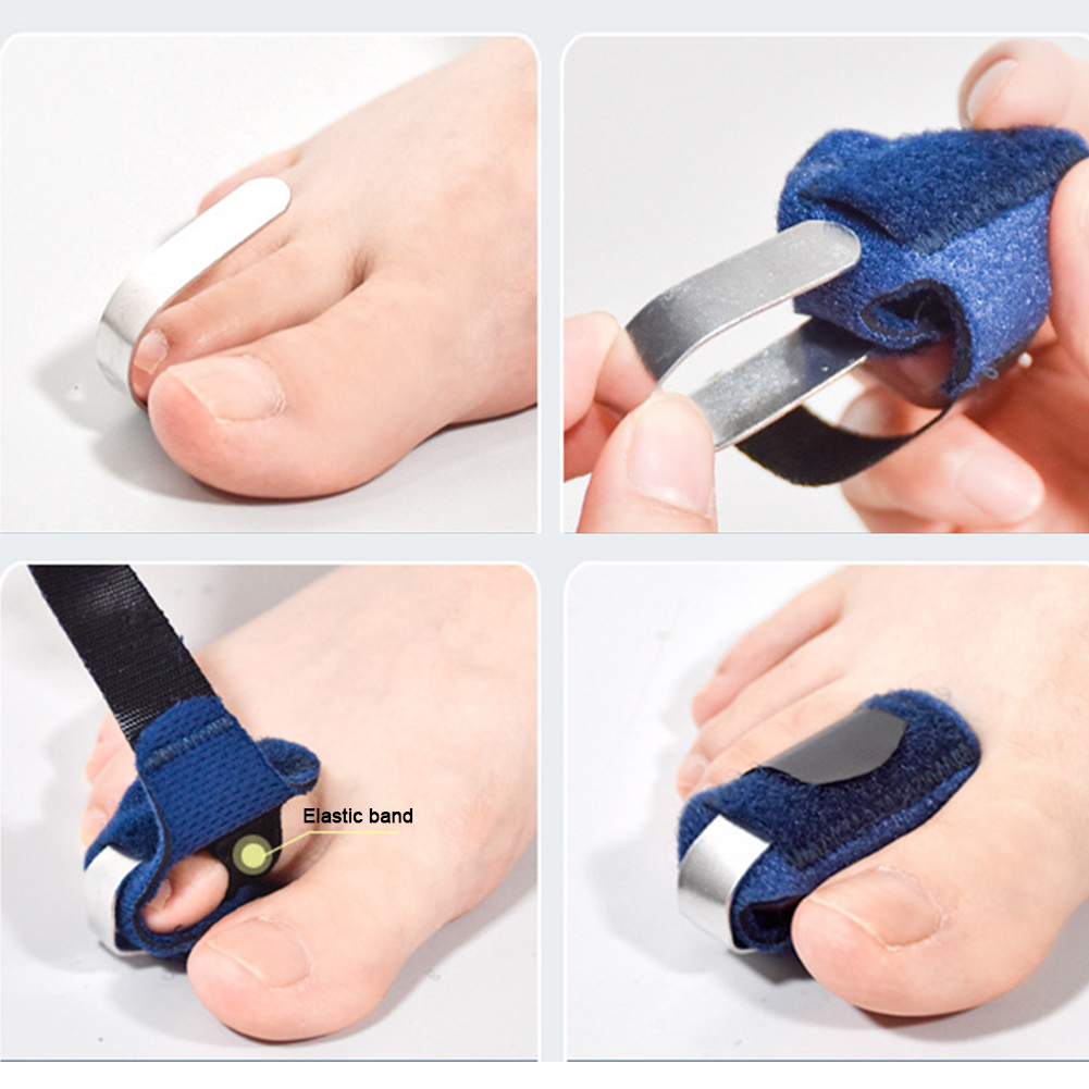 Toe Splint Straightener For Hammer Toe Corrector Crooked Toe Claw Toe Stabilizer Support Feet Corrector Pain Relief Toe Splint Straightener For Hammer Toe Corrector Crooked Toe Claw Toe Stabilizer Support Feet Corrector Pain Relief